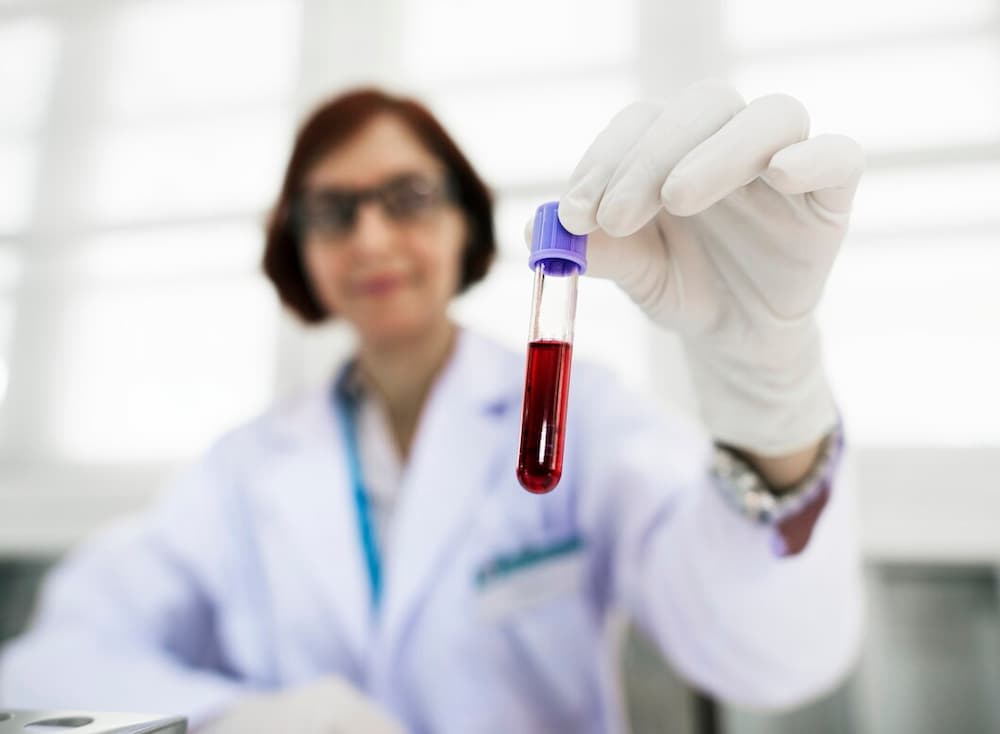 Exame de sangue: É possível detectar gravidez?